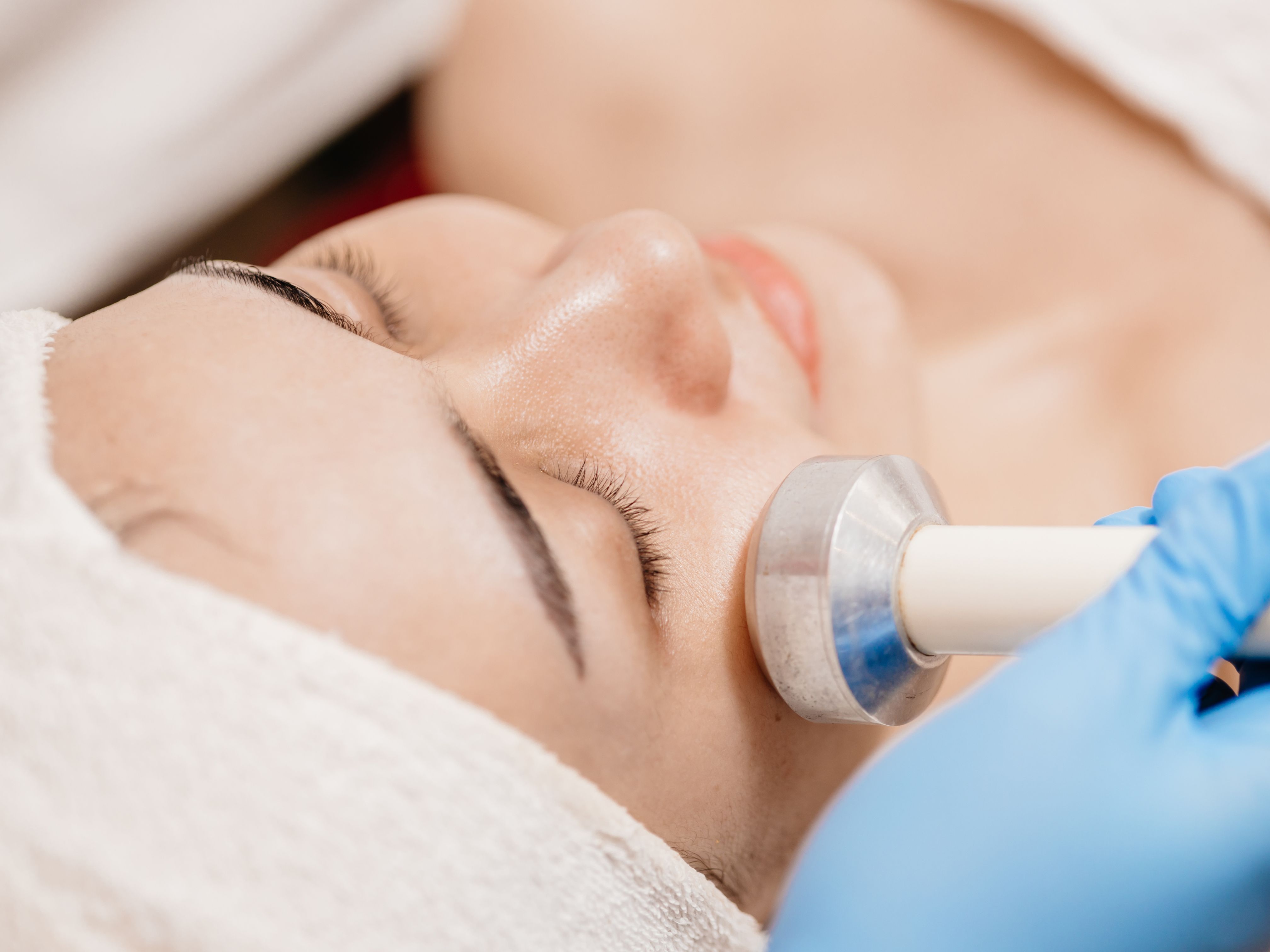 Pelleve Skin Tightening